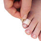 Pedi-Quick OneStep Corn Removers - Maximum Strength Pain Relief