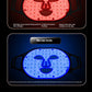 Red And Blue Everbright Bank Light Spectrum Mask Beauty Instrument