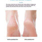 Mango-shaped Exfoliating Scrub Artifact Pedicure Device